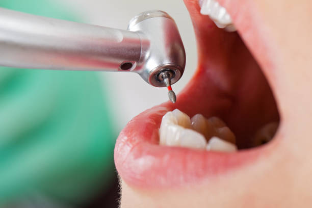 Best Urgent Dental Care for Toothaches in Crewe, VA